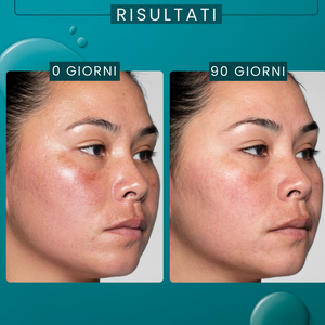 BOTIK Máscara Facial Reset Noturno Ácido Glicólico - Maschera viso notte Acido Glicolico 40gr