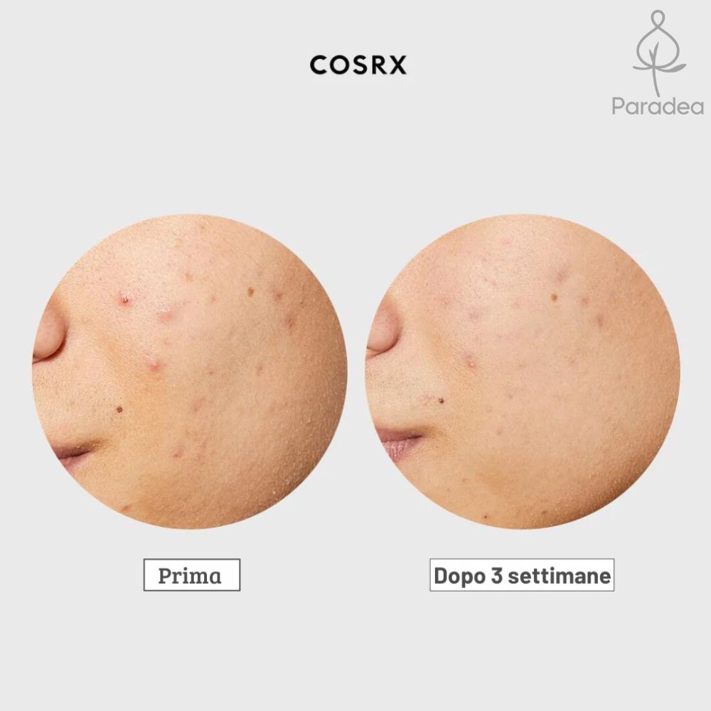 COSRX AC Collection Ultimate Spot Cream gegen Entzündungen – Lokale Aknebehandlung 30 g