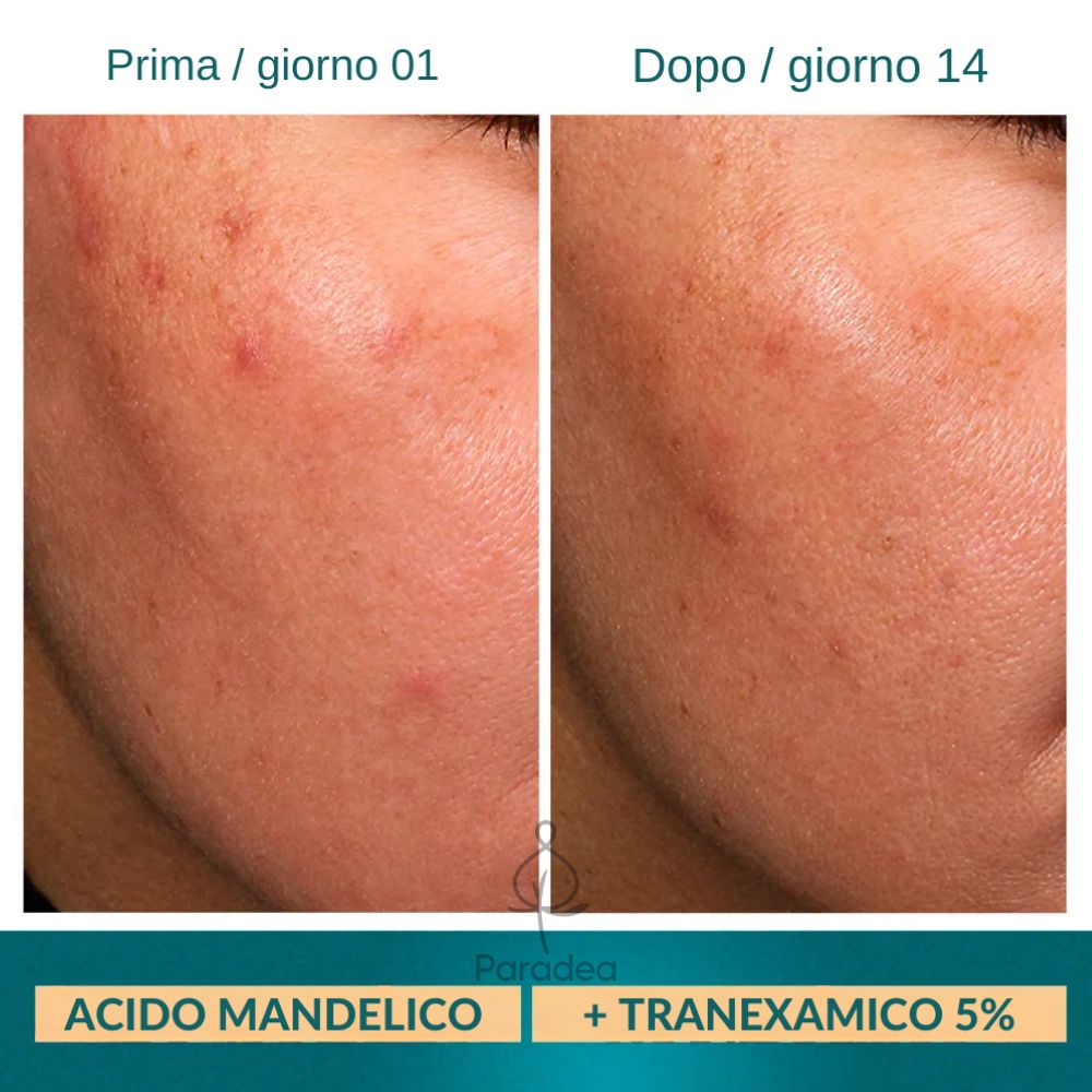 O Boticário Botik Gel Creme Uniformizador de Olheiras Ácido Mandélico + Tranexâmico - Crema Gel occhiaie 15gr - o Boticário | Paradea